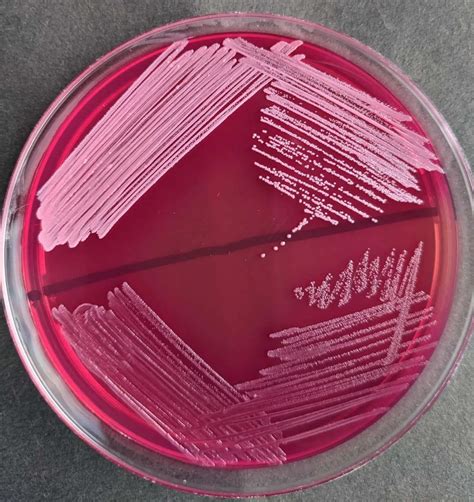 pink colonies on blood agar